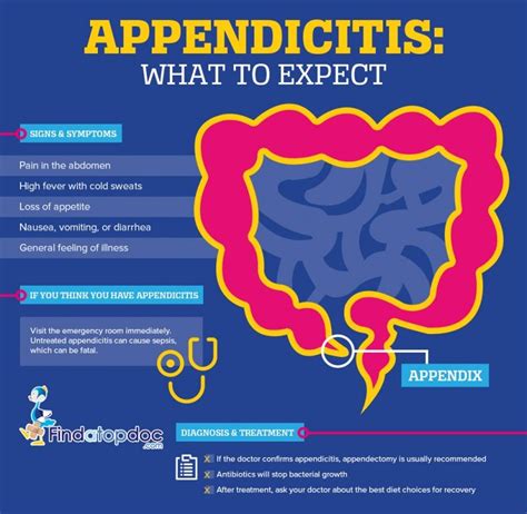 What Is Appendicitis Facts About Appendicitis Infographic