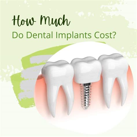 How Much Do Dental Implants Cost Archpoint Implant Dentistry