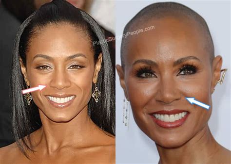 Jada Pinkett Smith Before And After 2022
