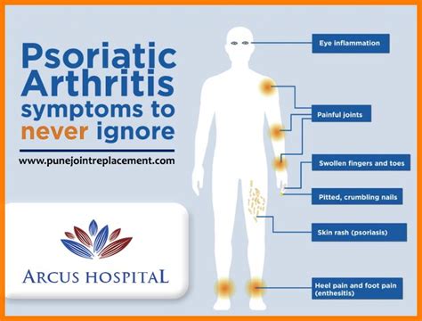Psoriatic Arthritis Psoriatic Rheumatoid Arthritis Treatment