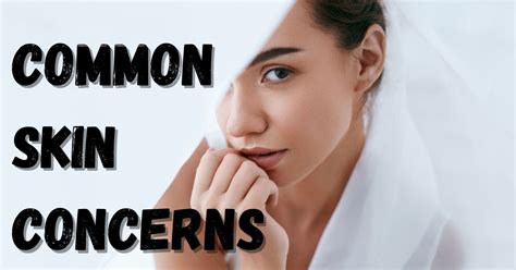 What Are The Most Common And Top Skin Concerns Daily Illinois Usa