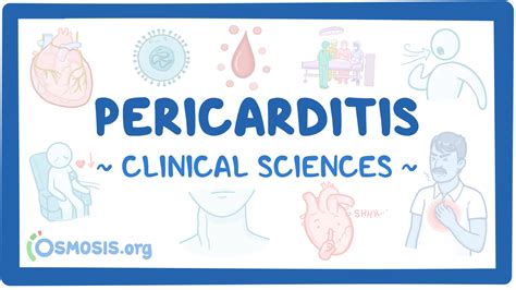 Pericarditis Clinical Sciences Osmosis Video Library