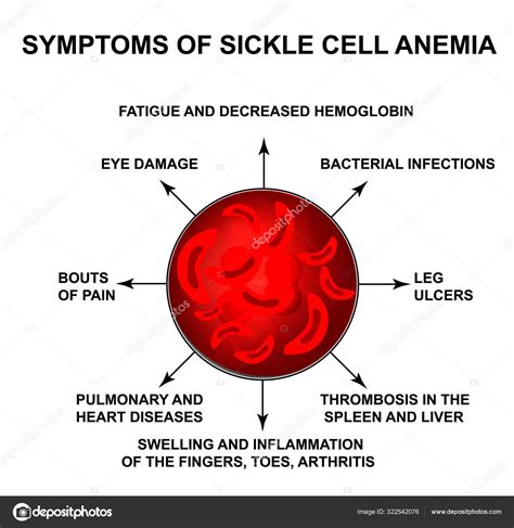 Symptoms Of Sickle Cell Anemia World Sickle Cell Anemia Day 19 June
