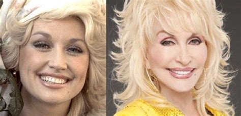 Dolly With A Reported Face Lift Who Wouldnt Have A Little Somthin