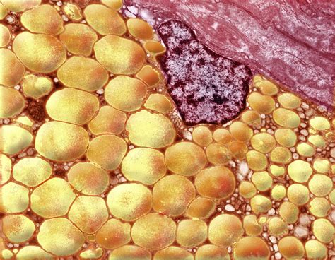 Human Fat Cell Stock Image P7600072 Science Photo Library