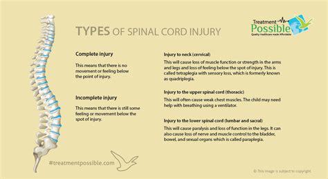 Spinal Cord Injury Treatment Treatment Possible