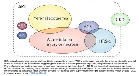 Acute Kidney Injury Principles Of Diagnosis And Renoresuscitation In