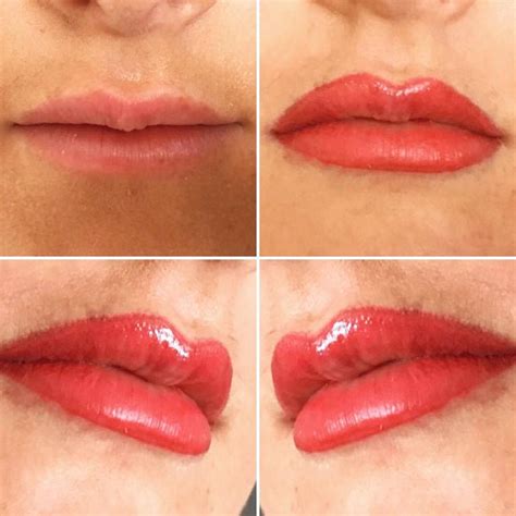 Before And Straight After Pmu Full Lips Done By The Uk