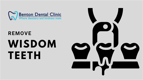 Best Wisdom Teeth Removal In Kitchener