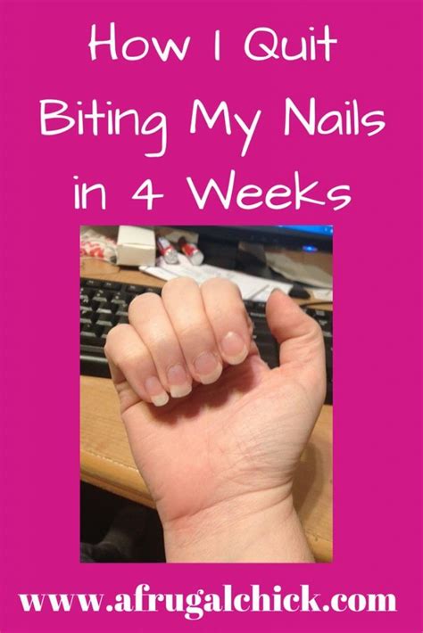 How I Quit Biting My Nails Nail Chewing Nail Biting Remedies Quit