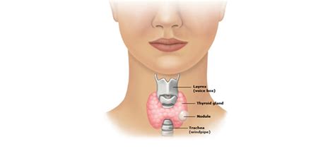 Thyroid Surgery Thyroidectomy The Thyroid Head Neck Surgery Centre