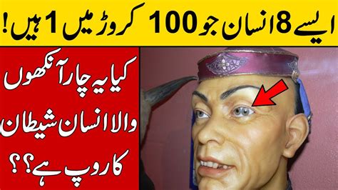8 Such People Who Are 1 In 1000 Crores Rarest People On Earth