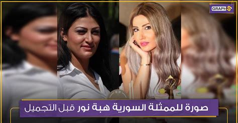 تتوفَّر خدمة gmail على جميع الأجهزة التي تعمل بنظامي التشغيل android وios وأجهزة سطح المكتب. بالصور: الممثلة السورية هبة نور قبل عمليات التجميل وبعدها ...