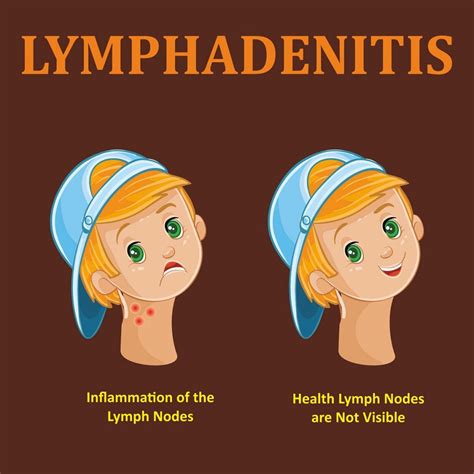 Albums 91 Pictures Pictures Of Swollen Lymph Nodes In Armpit Full Hd
