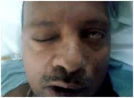 561 x 540 jpeg 88 кб. Otocerebral Mucormycosis: A Rare Case in a Diabetic ...