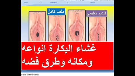 ‫غشاء البكارة انواعه ومكانه وطرق فضه‬‎ Youtube