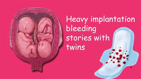 heavy implantation bleeding twins stories