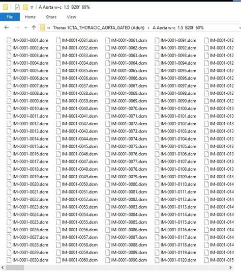 How To Open Dcm File Remember Different Programs May Use Dcm Files