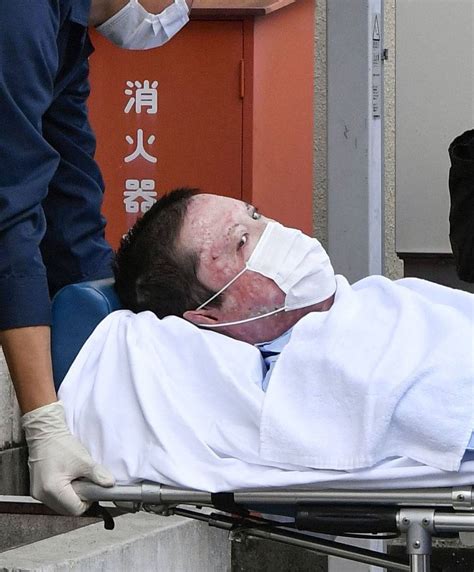 Man To Be Indicted Over Deadly Kyoto Animation Arson Attack The Japan