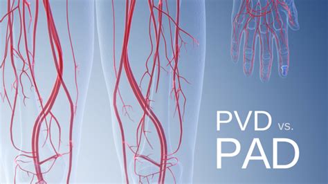 Are Pad And Pvd The Same Disease Cardiovascular Medicine