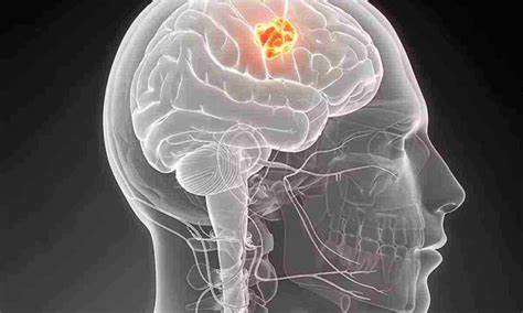 Диета при вбн Лікування вертебробазилярної недостатності мозку Лікування вертебробазилярної недостатності мозку Диета при вбн