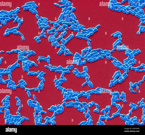 La Salmonella Typhi Color Scanning Electron Microfotografia Sem