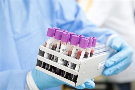 Blood Sample Lab Laboratory Scientist Medical Health Test