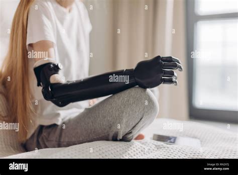 Woman Amputee Arm Stock Photos And Woman Amputee Arm Stock Images Alamy