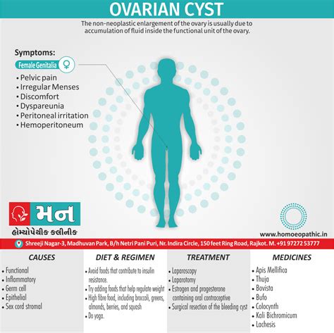 Ovarian Cyst Mann Homeopathy Clinic Rajkot