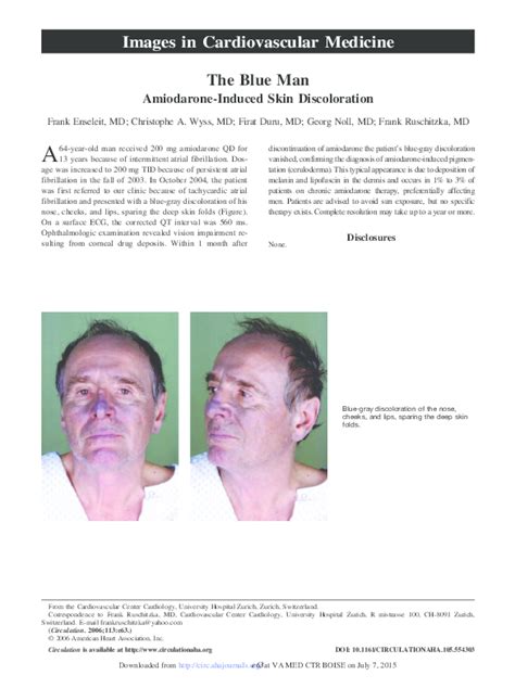Pdf The Blue Man Amiodarone Induced Skin Discoloration Firat Duru