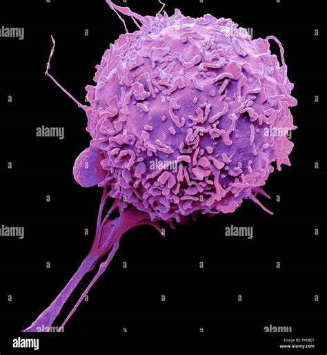Macrophages Phagocytose Bacteria Hi Res Stock Photography And Images