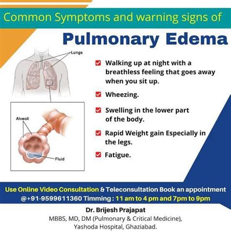 Symptoms Of Pulmonary Edema Medizzy