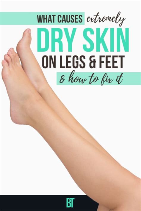 What Causes And How To Treat Dry Skin On Legs Skin Care Tips