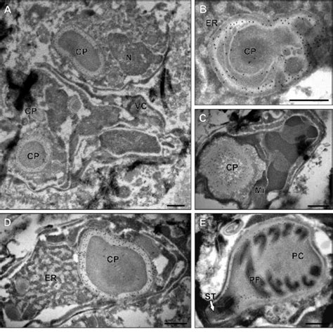 Transmission Electron Microscopy Of Immunogold Labelled Ncol During