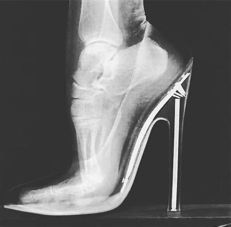 1 The X Ray Below Shows How Wearing High Heels Exert Considerable