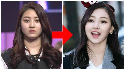 Kpop Idol Plastic Surgery Before And After