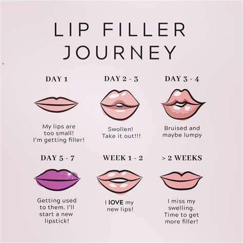 Your Lip Filler Journey
