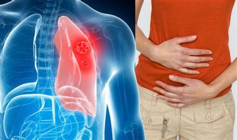 Lung Cancer Symptoms Signs Of A Tumour Include Nausea And Feeling