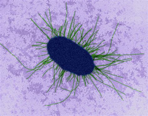 E Coli With Fimbriae 2 Photograph By Dennis Kunkel Microscopyscience