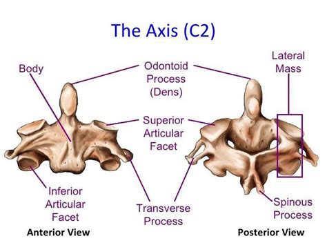 Processo Odontoide Do Axis