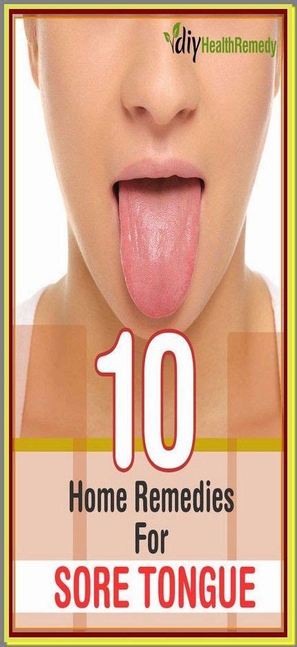 Natural Remedies To Treat Blisters On The Tongue At Home Tongue Sores