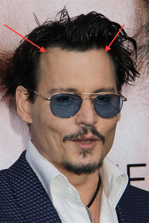 Celebrity Hair Loss Johnny Depp Goes Bald For Black Mass