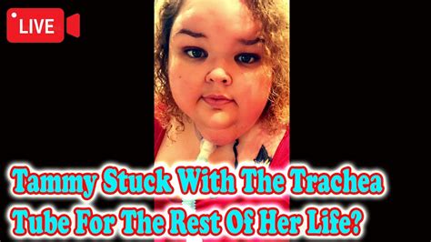tammy slaton stuck with the trachea tube for the rest of her life 1000 lb sisters 2022 youtube