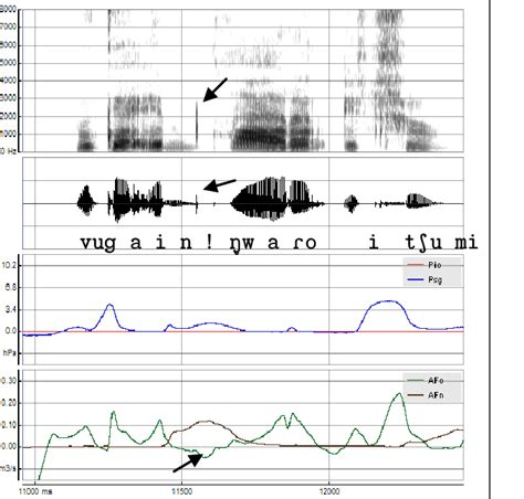 Spectrogram Audio Waveform Intraoral Pressure Pio Oral Afo And