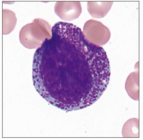 Promyelocyte Center With Azurophilic Granules In The Cytoplasm The