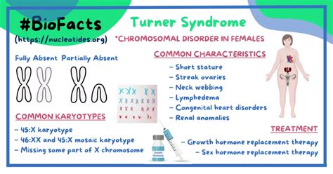 Turner Syndrome Cause Symptoms Diagnosis And Treatment Nucleotides