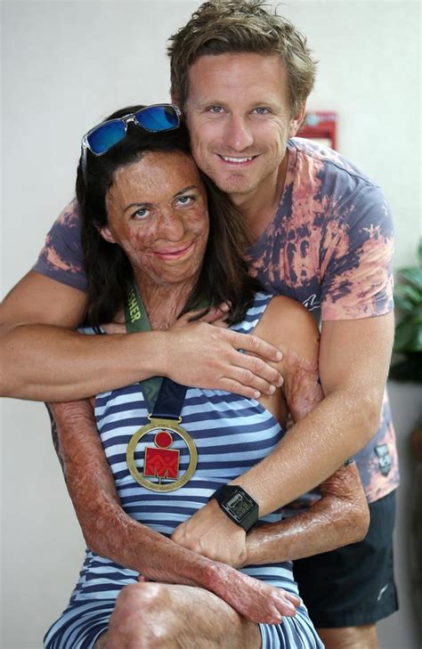 Turia Pitt On Pregnancy Ill Get A Baby From The Pain News Com Au Australias Leading