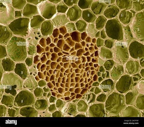 Xylem And Phloem Plant Tissue Coloured Scanning Electron Micrograph