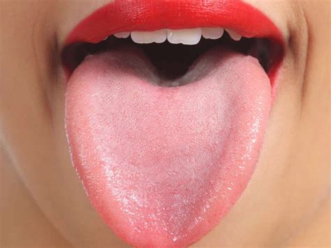 Pimples On Tongue Under On Tip Side Or Back And Getting