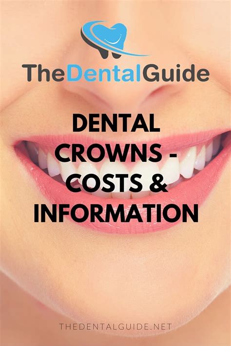 The cost of a crown varies between a price range of 300 $ to 1500 $. Dental Crowns - Costs & Information - The Dental Guide